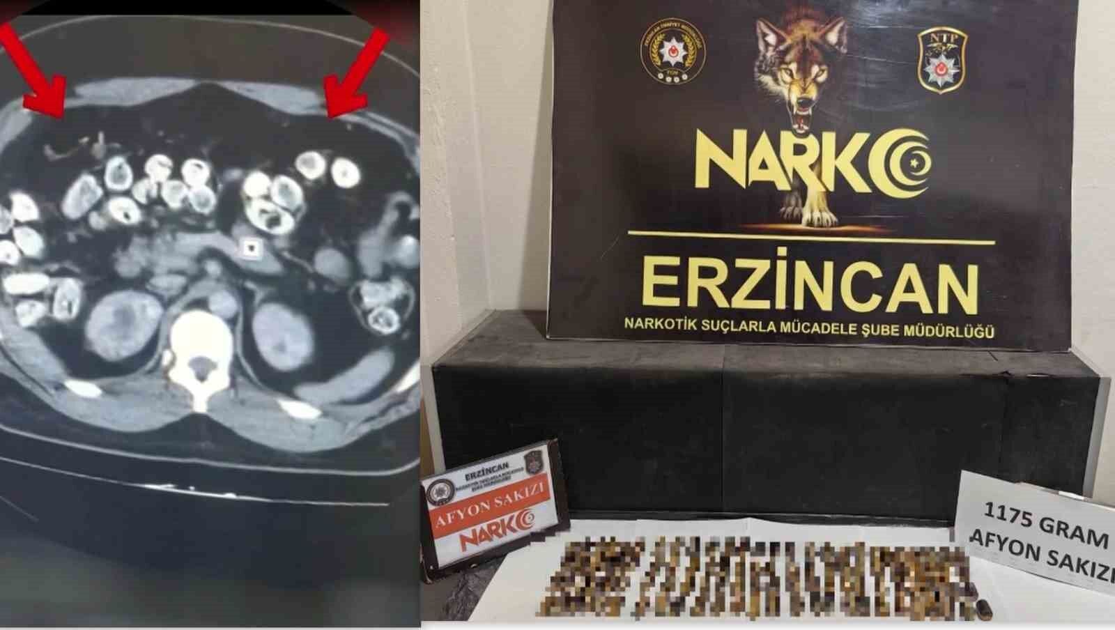 Erzincan'da uyuşturucuyu vücutlarında taşıyan 3 şüpheli yakalandı