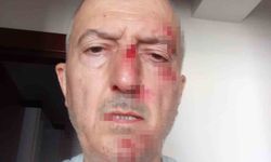 Önce icra yoluyla evinden tahliye edildi, ardından darp edildi
