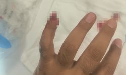 Uyuşturucuyla yakalanan şüpheli, polisin parmağını kopardı