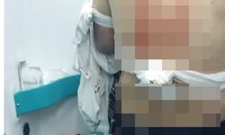 Abisini sokak ortasında silahla vurarak öldürdü