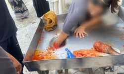 Kız çocuğu elini salça makinesine kaptırdı