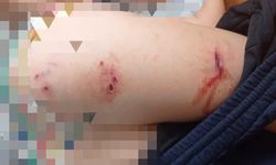 Sokak köpekleri faciaya neden oluyordu: Komşular yetişmeseydi parçalayacaklardı