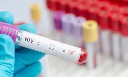 400 erkeğe bilerek HIV virüsünü bulaştırdı! Ülkede herkes paniğe kapıldı