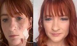 Doğumdan sonra bir fincan çay içti, hayatı adeta kâbusa döndü
