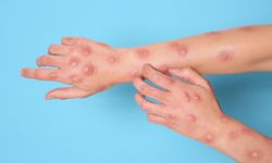 DSÖ'den ürküten açıklama: Yeni salgın kapıda