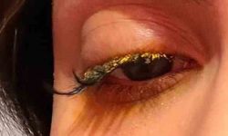 Güzellik merkezinde genç kadının gözüne yapıştırıcı kaçtı: "Kör olabilirdim"