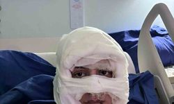 Kadıköy’de akıl almaz olay: Genç kadın başka bir kadın tarafından ateşe verildi