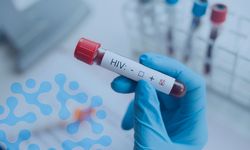 HIV alarmı!