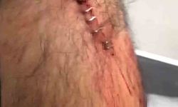 Şanlıurfa’da görev yapan öğretmene sokak ortasında jiletli saldırı