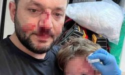 Baba ve 14 aylık kızının yaralandığı komşu kavgasında istenen ceza belli oldu