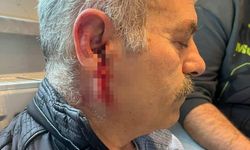 Silivri'de özel bakım merkezine çağrılan eski çalışan darbedildi