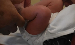 27 günlük bebek sünnet edildi: Yaşamını yitirdi