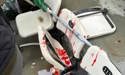 Bursaspor'dan saldırı sonrası tokat gibi cevap!