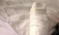 Yürüyen merdivene eli sıkışan çocuk bir parmağını kaybetti