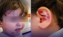 Bursa'da özel kreşte skandal! 2,5 yaşındaki çocuk darp edildi, ailesi görünce şoke oldu