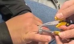 Batman'da parmağa sıkışan yüzük itfaiye ekiplerince çıkarıldı