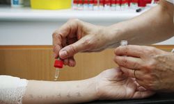 27. Ulusal İmmünoloji Kongresi Bursa’da düzenleniyor