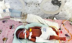 650 gram doğmuştu: Leyla bebek 4 aylık yaşam savaşını kazandı