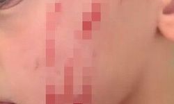 Van'da sokakta oynayan çocuğa saldırı: O anlar kamerada