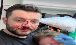 Kucağında bebeği olan babayı darbeden sanık tahliye edildi