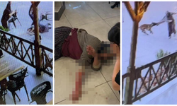 Afyonkarahisar'da köpek, kadının kolunu parçaladı