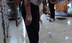 Bursa'da lavaboyu açmak için dökülen kimyasal madde patladı: 2 yaralı