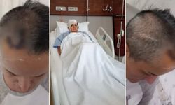 Diş ağrısı için gitti hayatı karardı