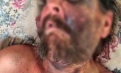 'Abimin cenazesine neden gelmedin' diyerek dövüp ölüme terk etmişler