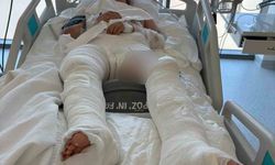 Otomobilin çarptıktan sonra üzerinden geçtiği genç kız ağır yaralandı