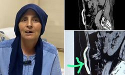 Kafatası kemiği sekiz ay karnında saklandı: Nakille sağlığına kavuştu