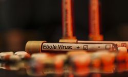Ebola salgınında can kaybı 3 bin 398'e ulaştı