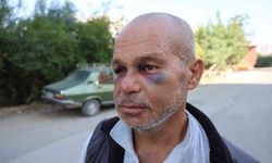 Duyma ve konuşma engelli adamı darp ettiler, aile şikayetçi oldu