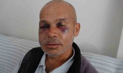 Engelli adamı darbeden şüpheli serbest bırakıldı