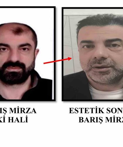 Ameliyat ile yüzünü değiştiren firari cinayet zanlısı, 7 yıl sonra yakalandı