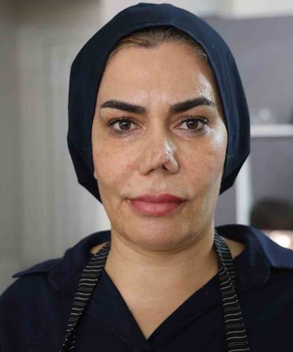 Bakım merkezinde burnu kırıldı, geçirdiği operasyon sonrası hayatı kabusa döndü