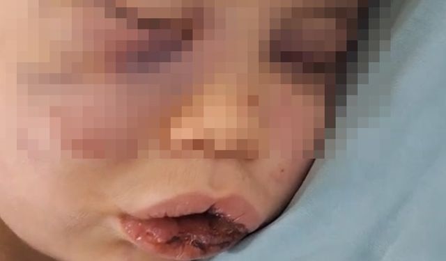 Vahşeti yaşayan 2 yaşındaki bebek hastanelik oldu