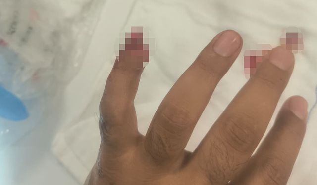 Uyuşturucuyla yakalanan şüpheli, polisin parmağını kopardı