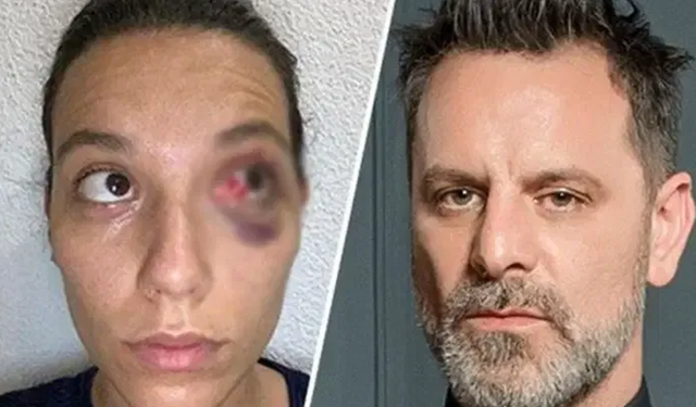 Ozan Güven 45 gün hapis yatacak! Cezası onandı