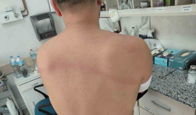 CHP’li dayakçı başkan hakkında ’Silahla kasten yaralamadan’ iddianame hazırlandı