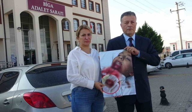 İlkokul öğrencisinin çenesi saplanan demir yüzünden koptu, ailesi okula ihmal davası açtı