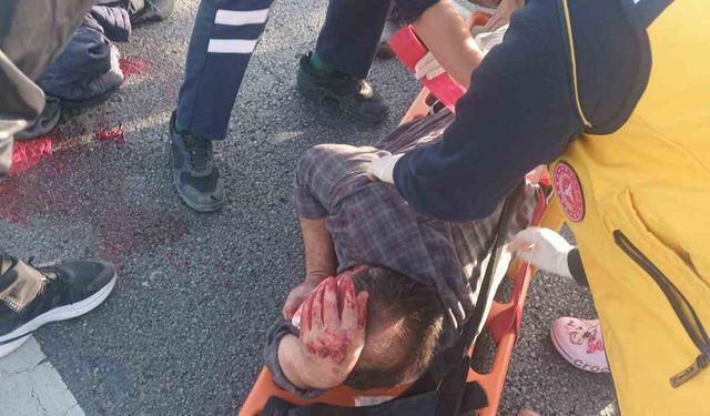 Köpeğe çarpmamak için manevra yapınca bariyerlere çarpıp yaralandı