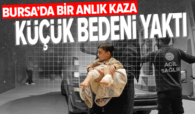 Üzerine çaydanlık devrilen çocuk yaralandı