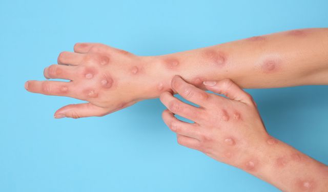 DSÖ'den ürküten açıklama: Yeni salgın kapıda