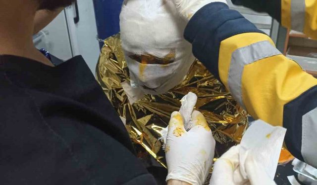 Erzincan’da kömür ocağında yangın: 2 işçi yaralı