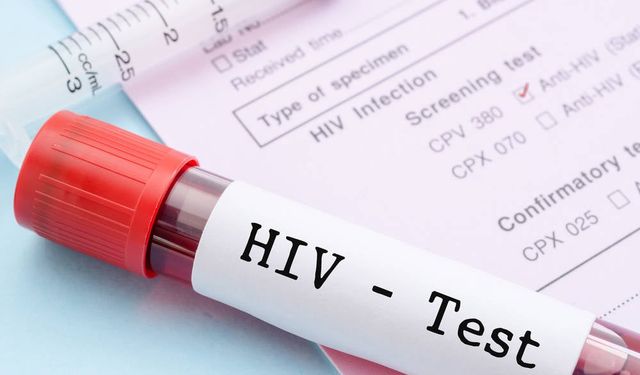 Türkiye'de HIV vakalarının yarısı teşhis bile alamıyor!