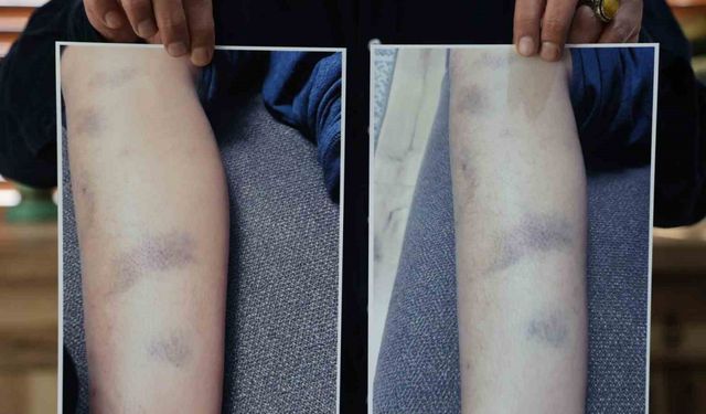 Özel okulda 8 yaşındaki çocuğun darbedildiği iddiası