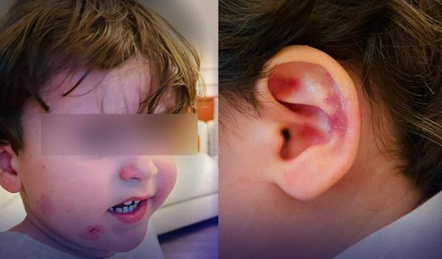 Bursa'da özel kreşte skandal! 2,5 yaşındaki çocuk darp edildi, ailesi görünce şoke oldu