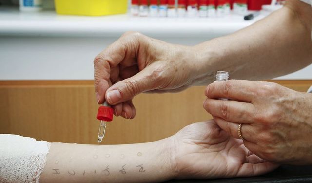 27. Ulusal İmmünoloji Kongresi Bursa’da düzenleniyor