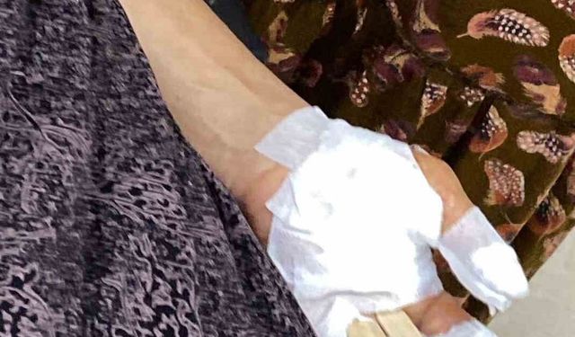 Şırnak'ta başıboş köpek dehşeti: 3 kişi yaralandı