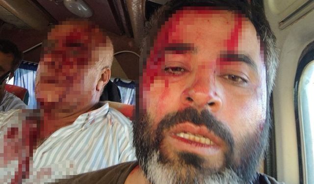 Akçakale'de meydan savaşı gibi kavga: 8 yaralı